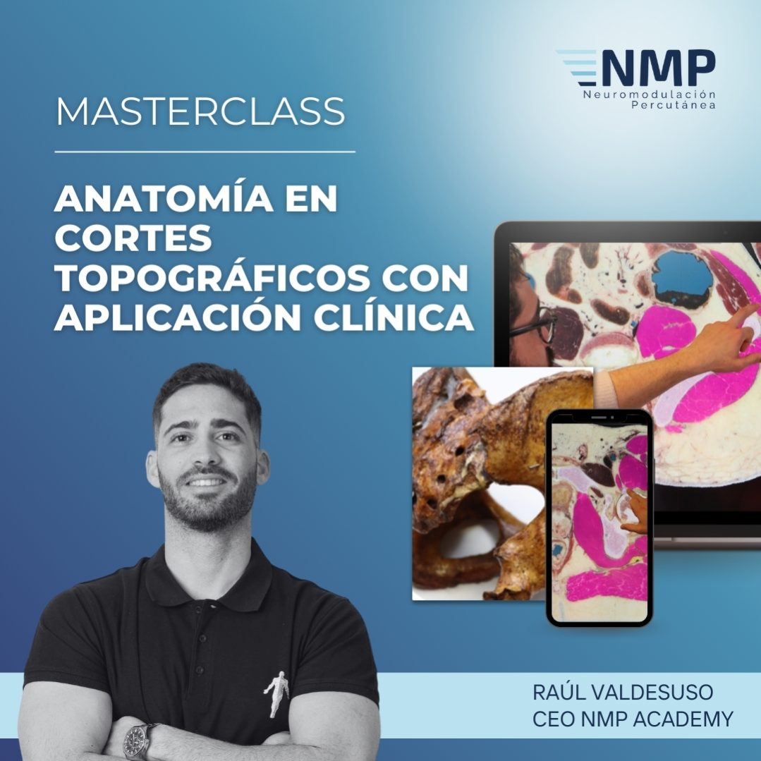 CURSO NEUROMODULACIÓN PERCUTÁNEA NMP (6).jpg